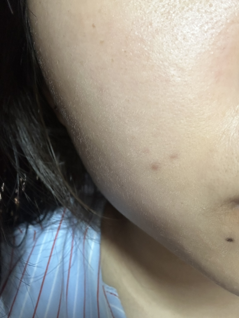 더멜라 (Dermela) 루미샷 더블 비타 스피큘 부스터 세럼 review image