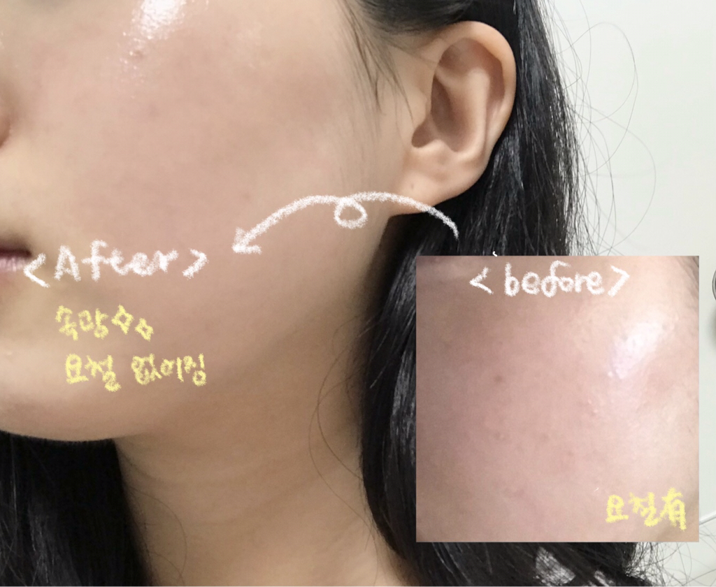 닥터상떼 (Dr.SANTE) 아줄렌 수더 토너 review image