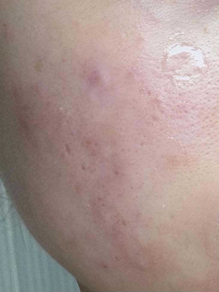肌肤屏障舒缓乳液的真实用户使用照片