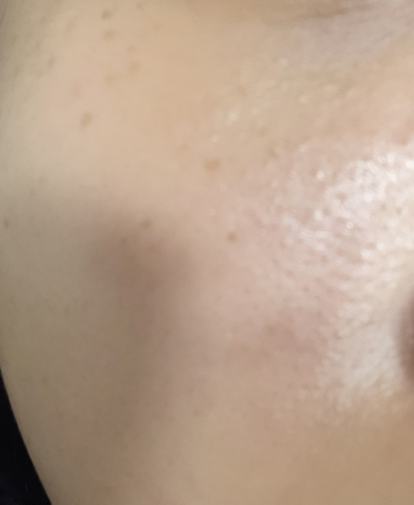 MEDIHEAL (美迪惠尔) 超级面膜[胶原蛋白] common.review image