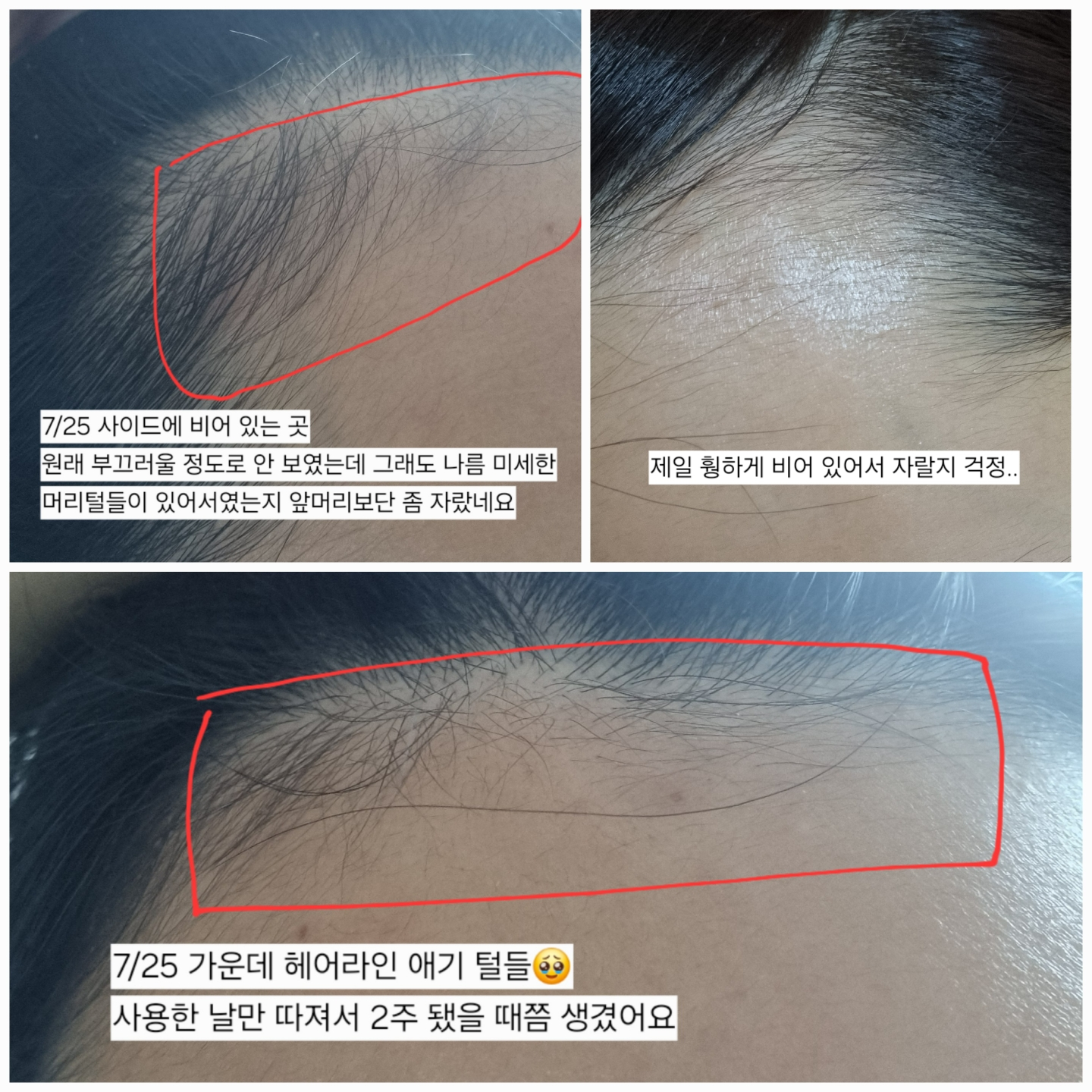 ViveLab 头发头皮和眉毛安瓿 common.review image