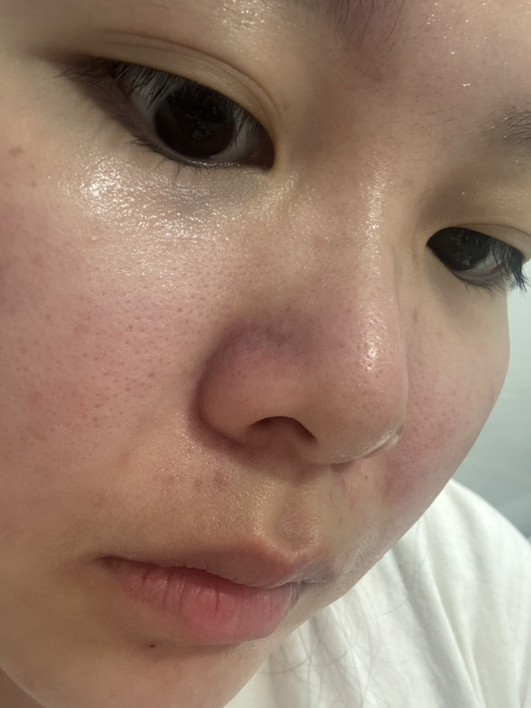 비플레인 (beplain) 녹두 모공 스케일링 워터 review image