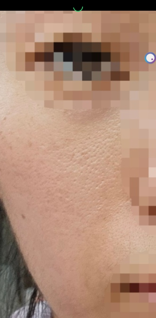MEDIHEAL (美迪惠尔) 必需口罩 [维生素C淡斑紧致] common.review image
