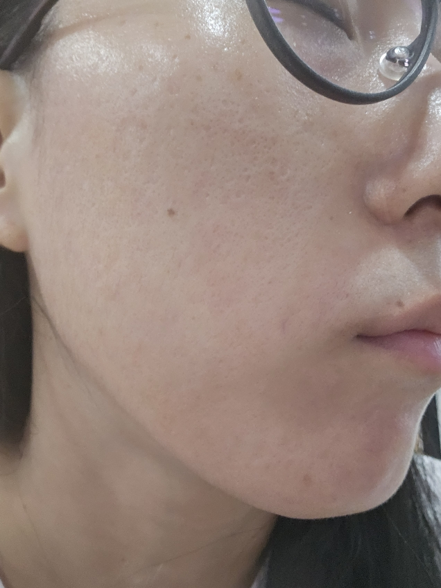 MEDIHEAL (美迪惠尔) 必需口罩 [维生素C淡斑紧致] common.review image