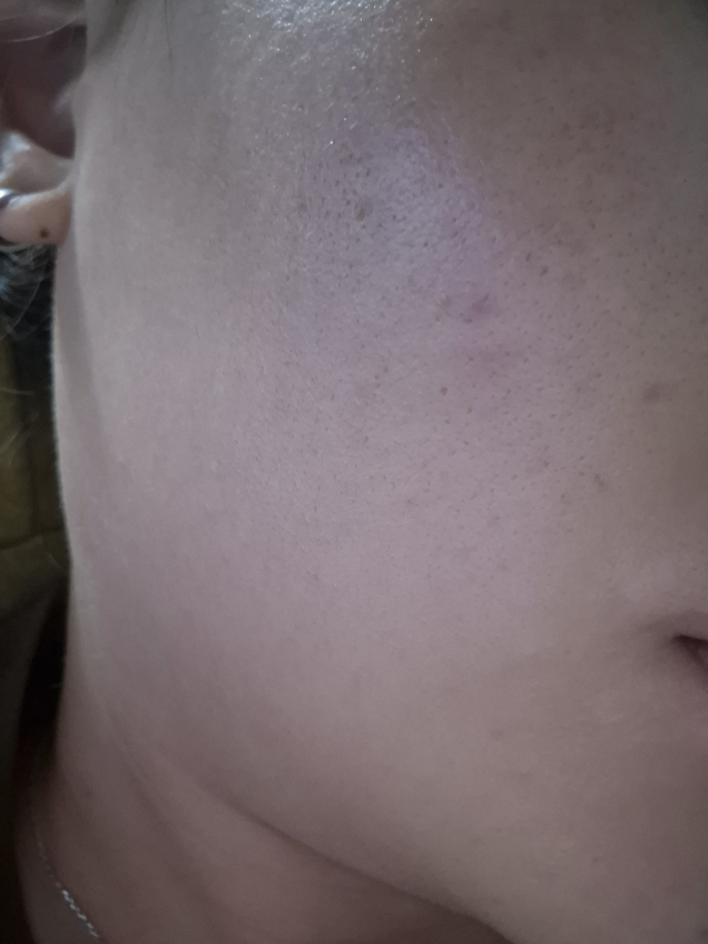 茶树精华舒缓爽肤水的真实用户使用照片