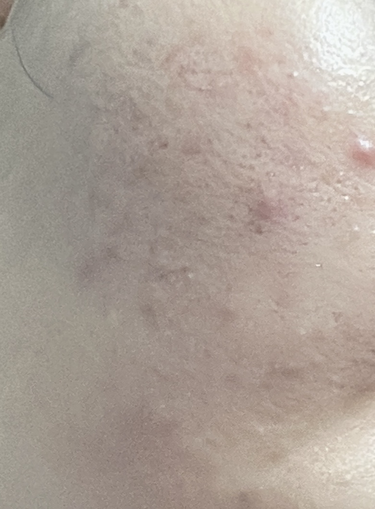 메디큐브 (medicube) PDRN 밀키 토너 에센스 review image