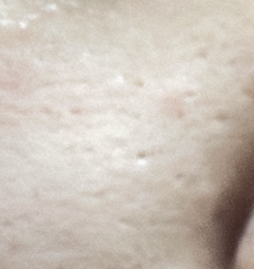 메디큐브 (medicube) PDRN 밀키 토너 에센스 review image