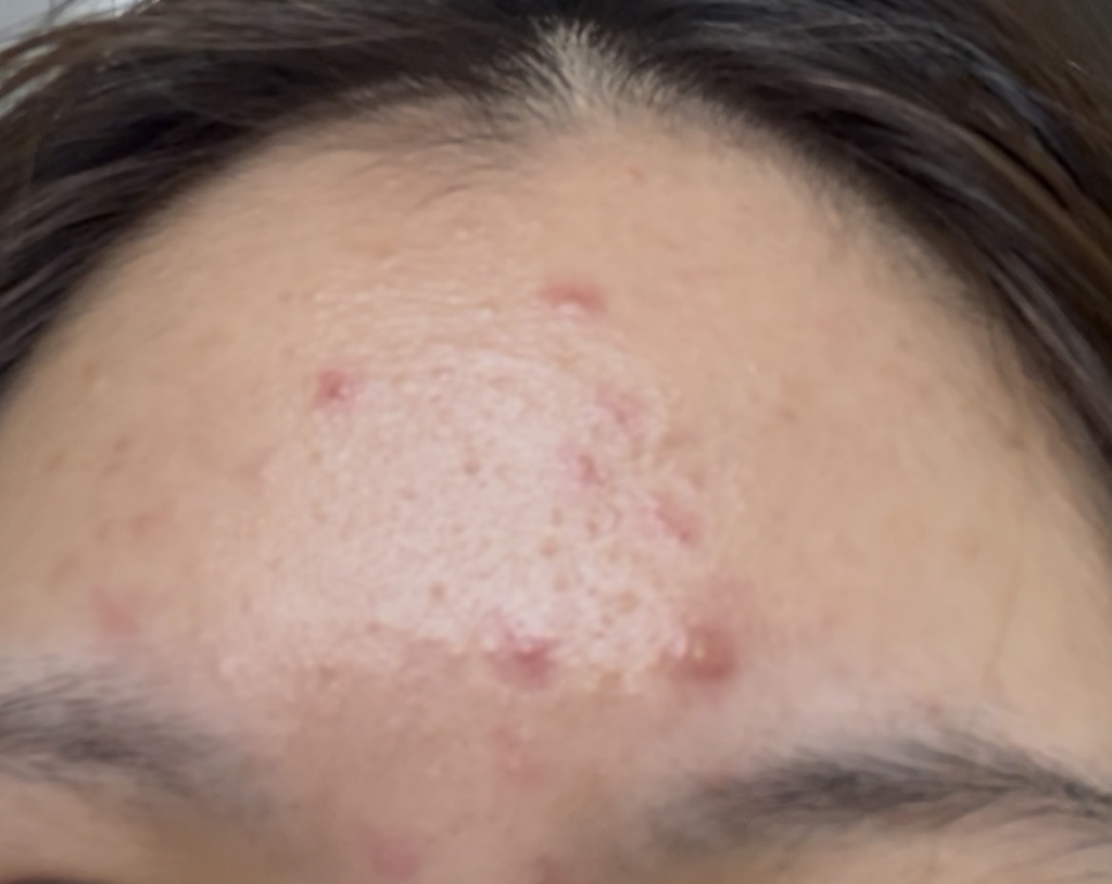 NANORECIPE 蒲公英提取物原液 common.review image