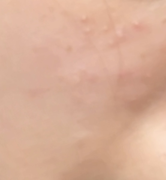 希卡普拉斯特夜间B5+的真实用户使用照片