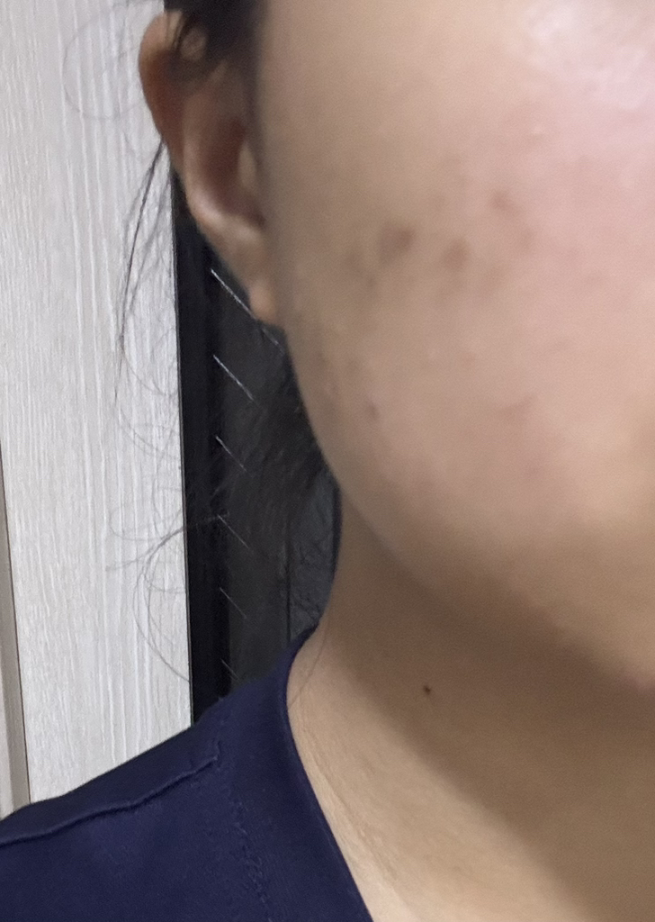 닥터스터치 (Dr+sTouch) 딥이펙트 스피큘레이션 에센스 review image