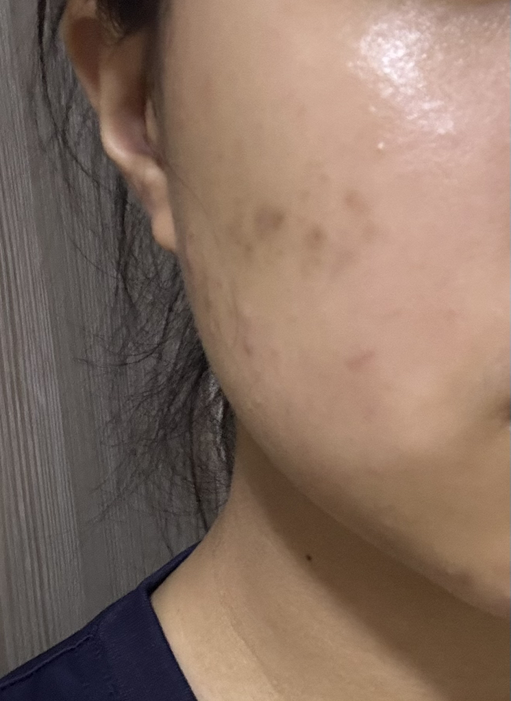 닥터스터치 (Dr+sTouch) 딥이펙트 스피큘레이션 에센스 review image