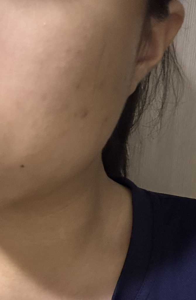 닥터스터치 (Dr+sTouch) 딥이펙트 스피큘레이션 에센스 review image