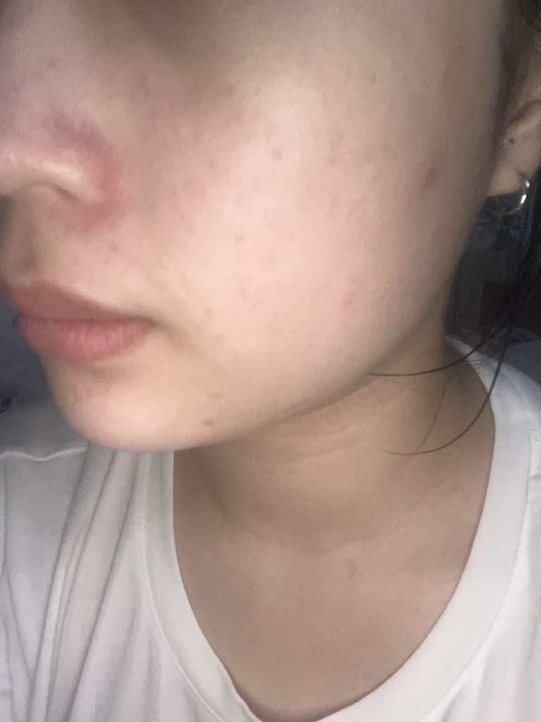 Fosera Real Bifida 无瑕面霜的真实用户使用照片