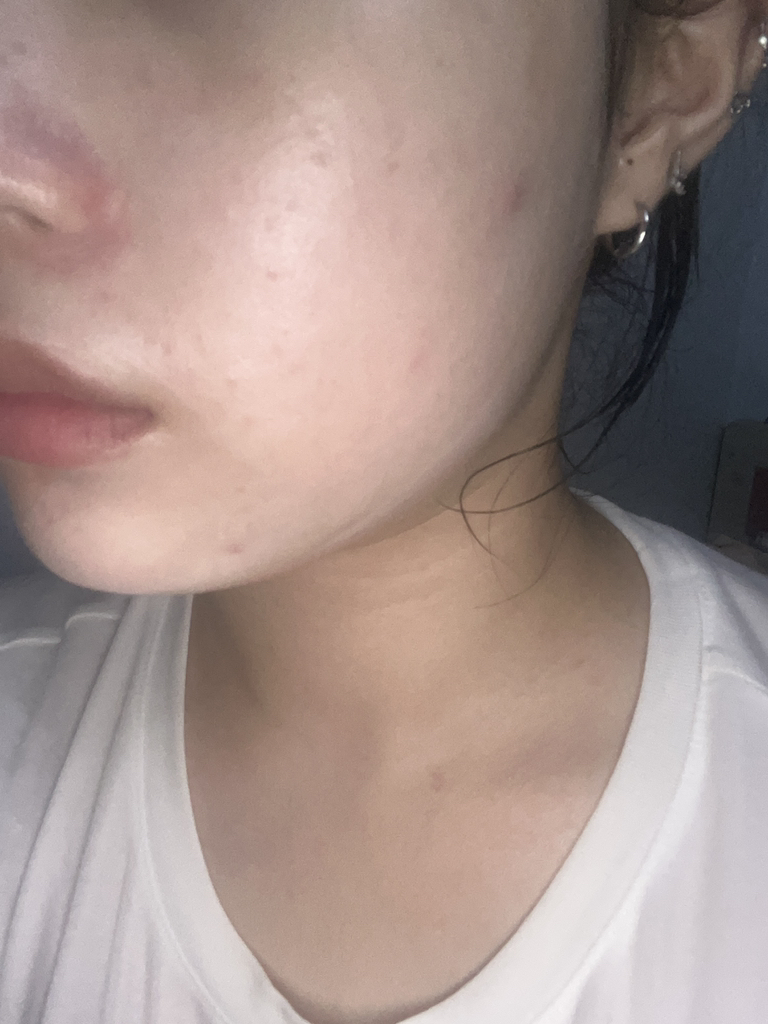 Fosera Real Bifida 无瑕面霜的真实用户使用照片