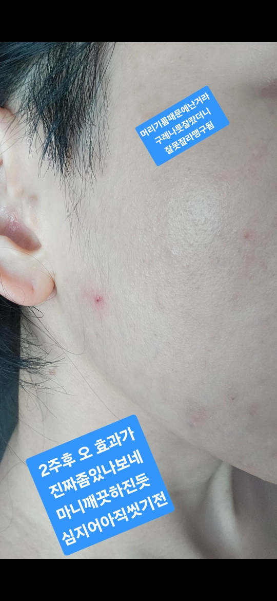 绿色西卡胶原蛋白清洁凝胶2.0的真实用户使用照片