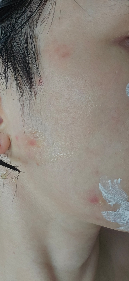 메디필 (MEDIPEEL) 그린 시카 콜라겐 클리어 젤 클렌저 2.0 review image