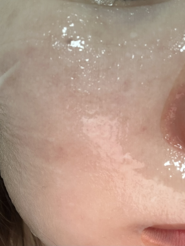 马德卡索赛德精华面膜[痕迹修复]的真实用户使用照片