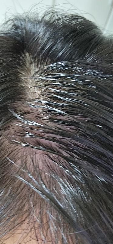 릴리이브 (lilyeve) 그로우턴 앰플 review image