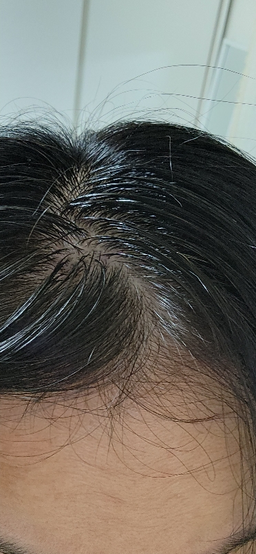 릴리이브 (lilyeve) 그로우턴 앰플 review image
