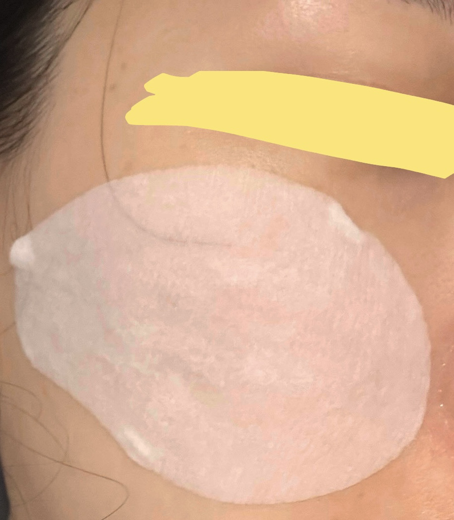 아이레시피 (irecipe) 시카 PDRN 흔적 클리어 토너패드 review image