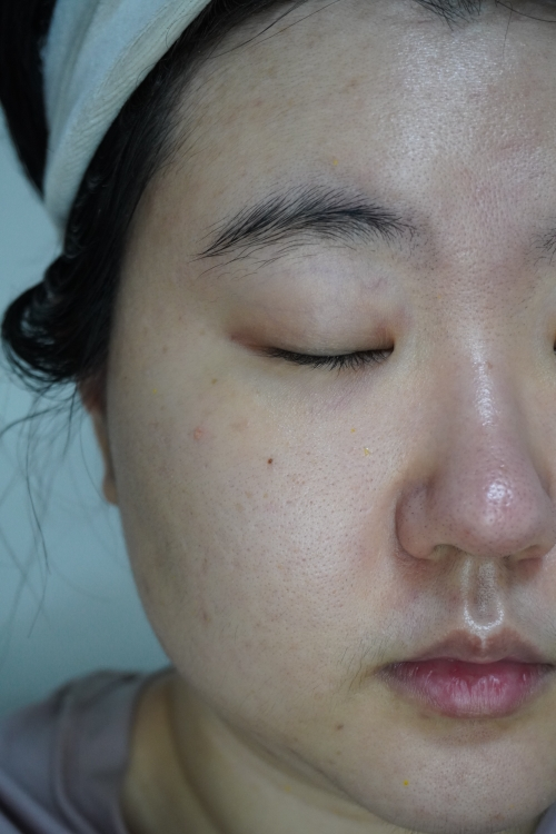 키노닉스 (keenoniks) 비타 씨 브라이트닝 세럼 review image