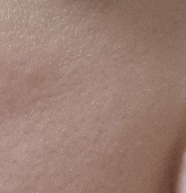 메디힐 (MEDIHEAL) 피디알엔 모공 탄력 세럼 review image