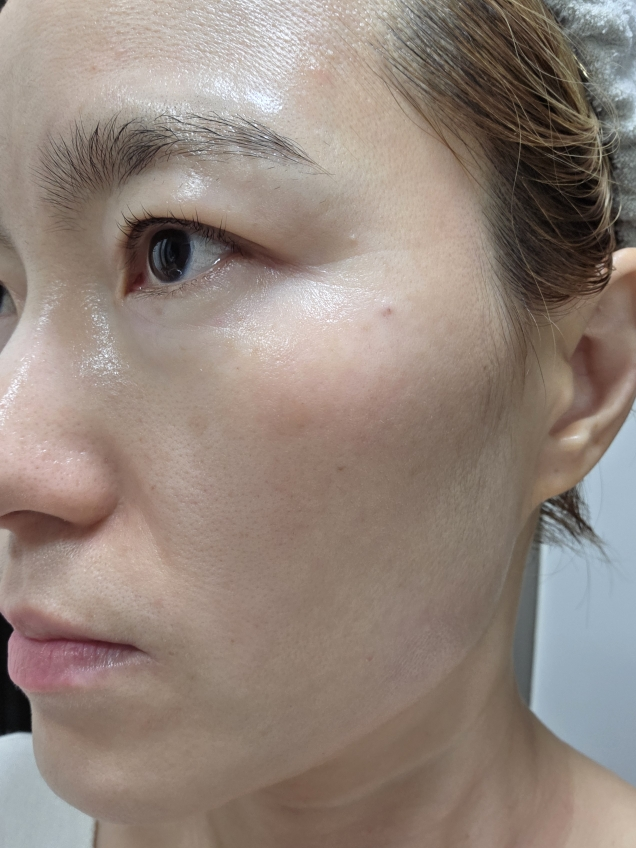 Torriden (桃瑞丹) 平衡肌肤舒缓控油精华 common.review image
