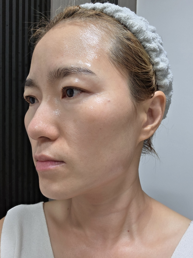 Torriden (桃瑞丹) 平衡肌肤舒缓控油精华 common.review image