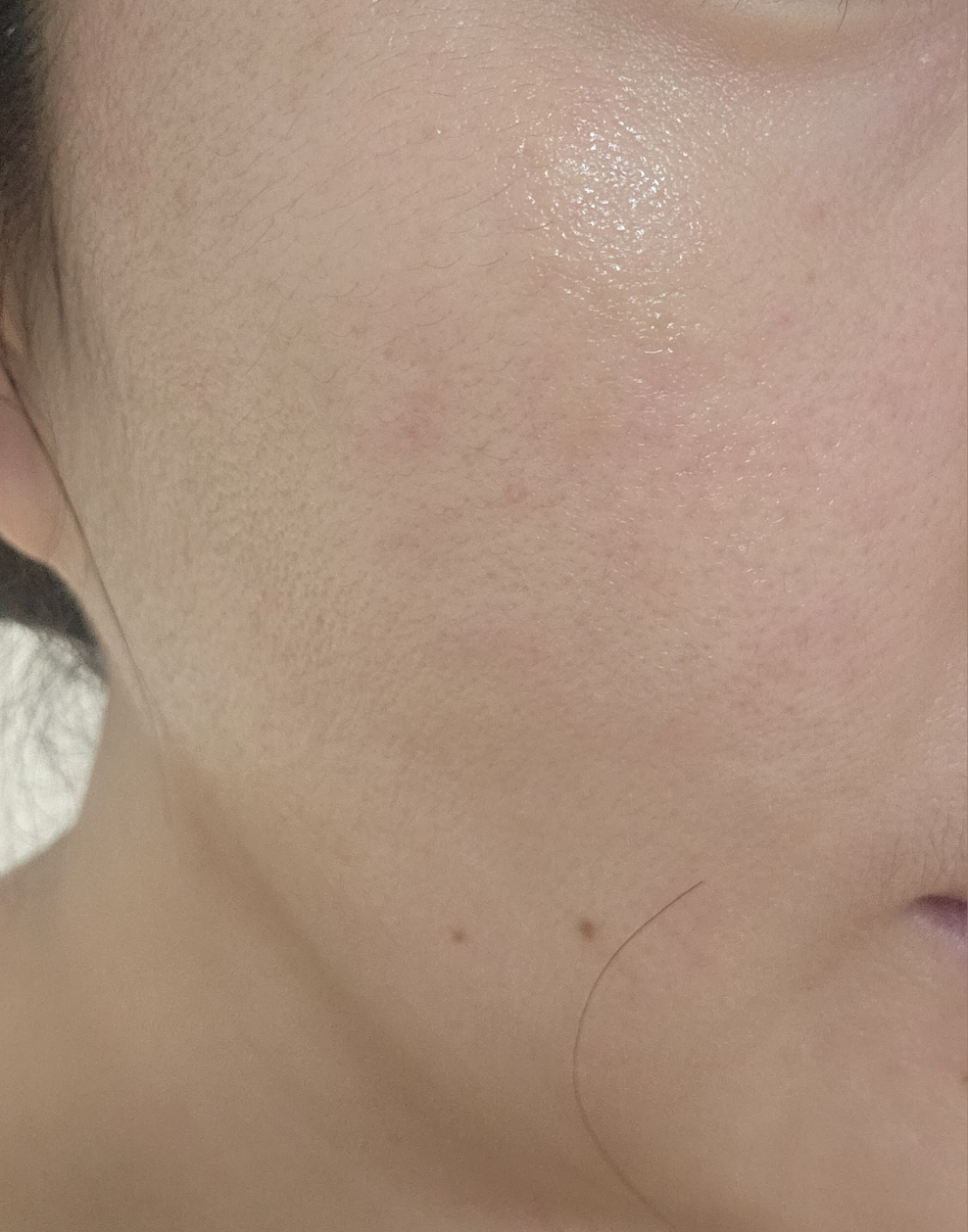 아누아 (Anua) PDRN 히알루론산 캡슐 100 세럼 review image