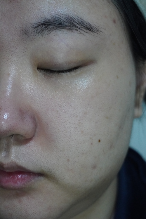 라루셀 (LALUCELL) 비타민 12 브라이트닝 세럼 review image