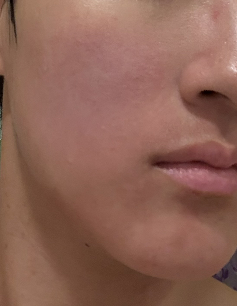 닥터지 (Dr.G) 약산성 클렌징 젤 폼 review image