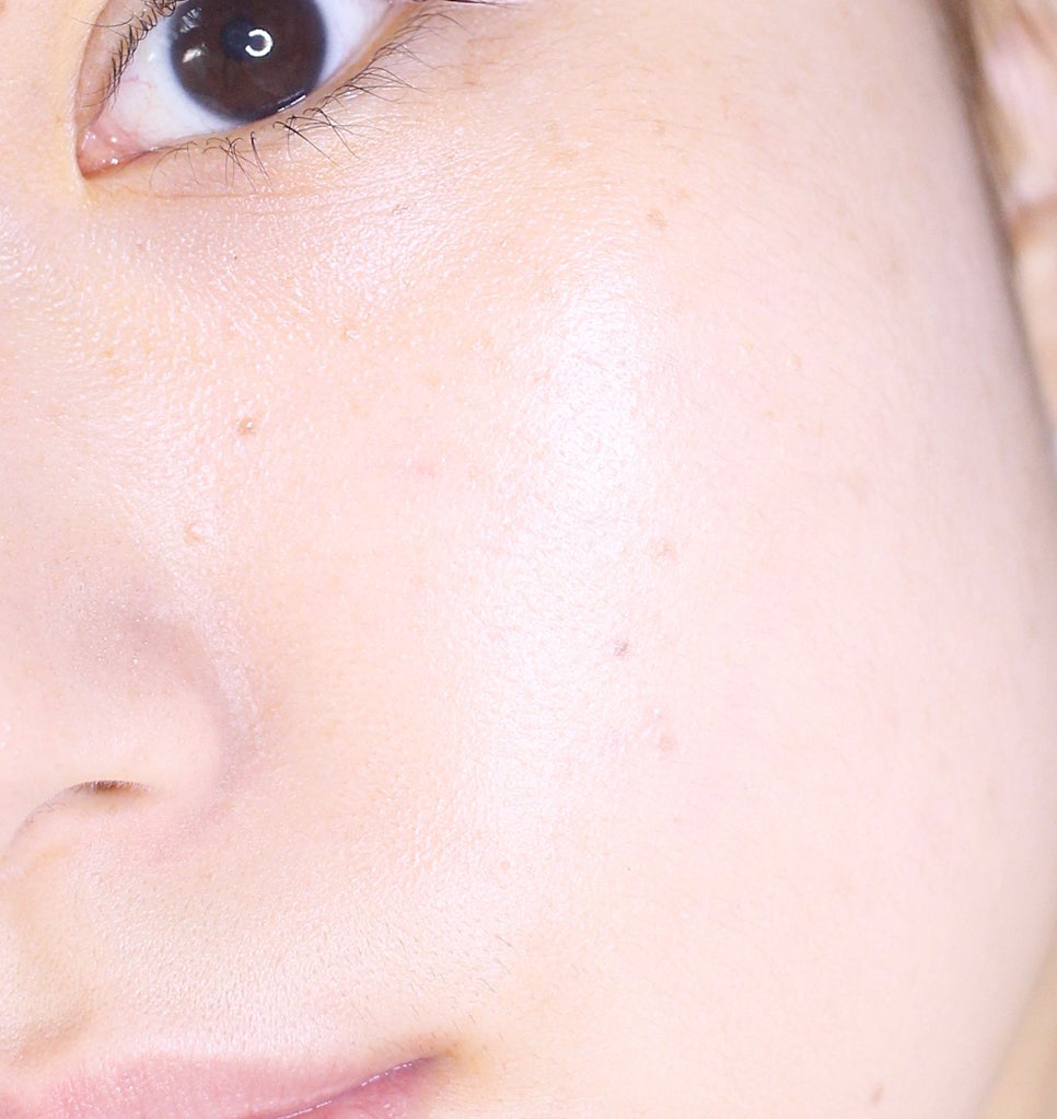 유이크 (UIQ) 바이옴 베리어 파하 결 앰플 review image
