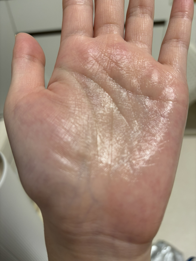 祛痘修护精华液的真实用户使用照片