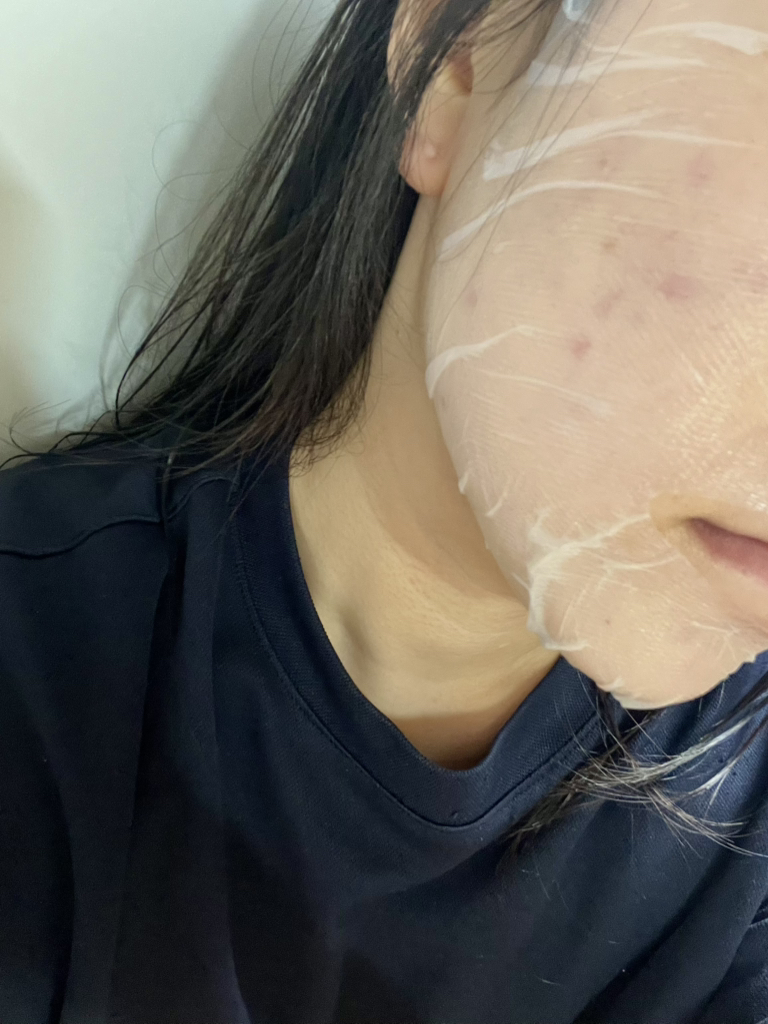이옴 (EIoM) 트러블 패치 마스크 review image