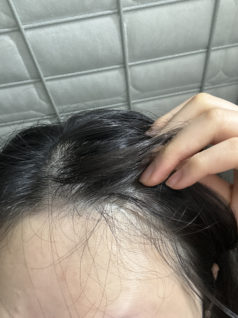 ViveLab 头发头皮和眉毛安瓿 common.review image