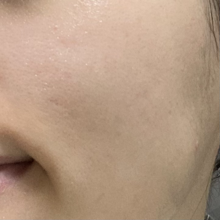 MEDIHEAL (美迪惠尔) 必需面膜 [茶树镇定补水] common.review image