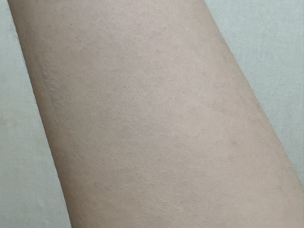 阿朱伦润肤乳的真实用户使用照片