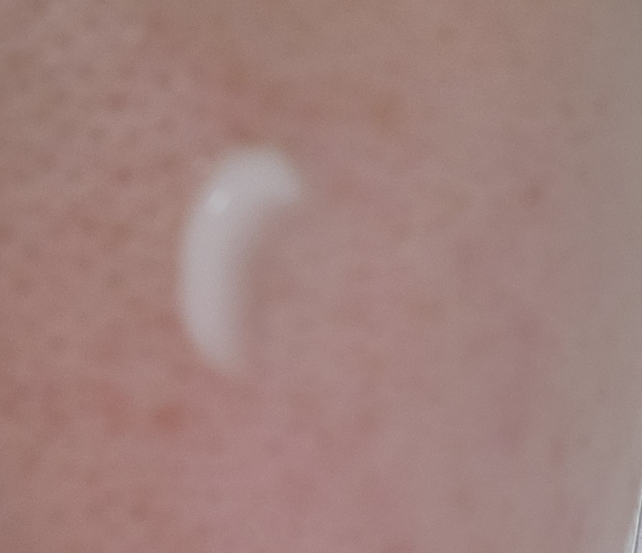 아이소이 (ISOI) 모이스춰 닥터 크림 review image