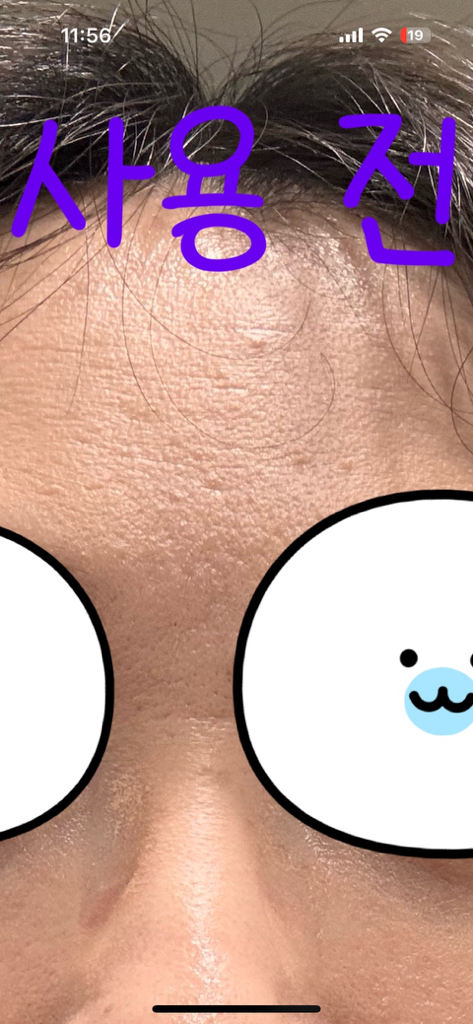 메디힐 (MEDIHEAL) 피디알엔 모공 탄력 패드 review image