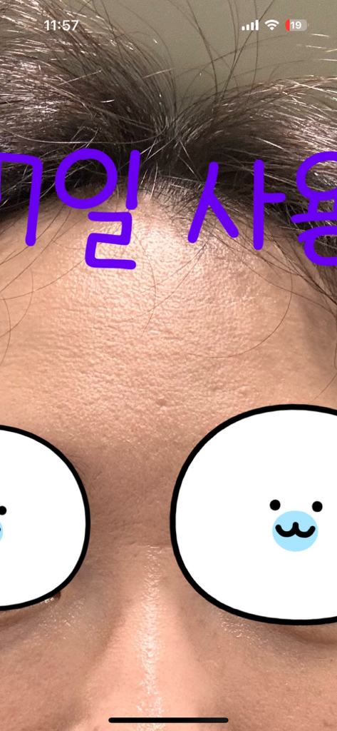 메디힐 (MEDIHEAL) 피디알엔 모공 탄력 패드 review image