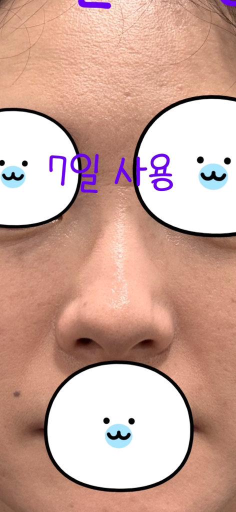 메디힐 (MEDIHEAL) 피디알엔 모공 탄력 패드 review image