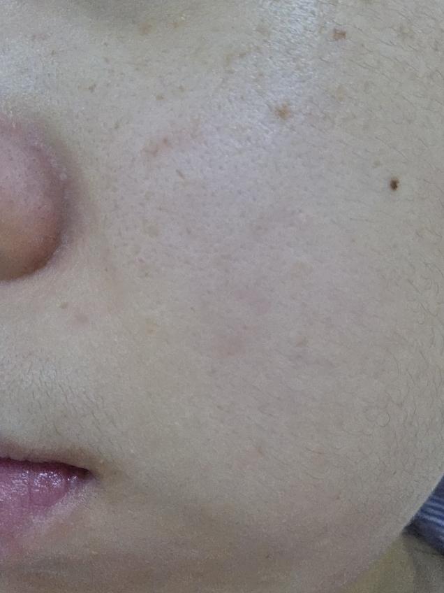 毛孔紧致垫的真实用户使用照片