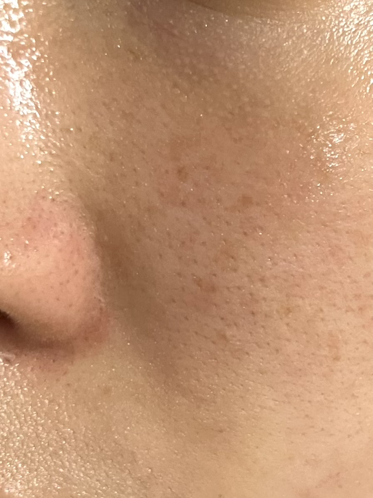 绿豆毛孔紧致舒缓乳霜的真实用户使用照片