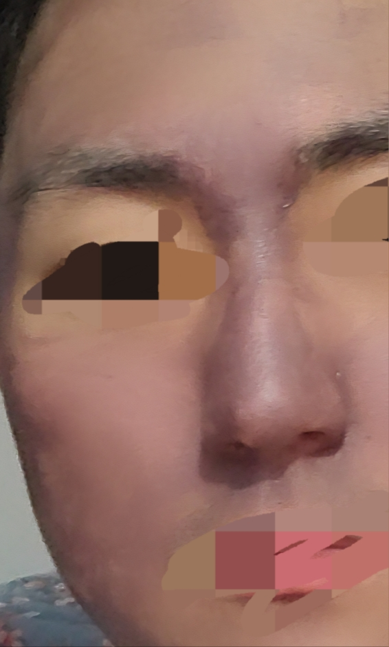 Paparecipe 去屑清洁泥浆面膜 common.review image