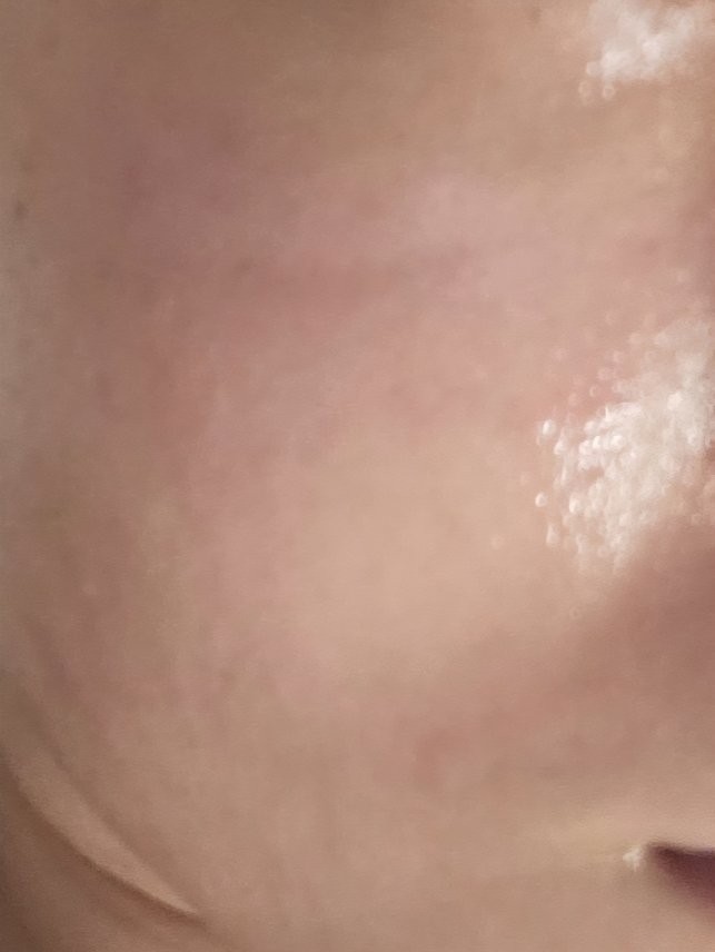 绿豆毛孔紧致舒缓乳霜的真实用户使用照片