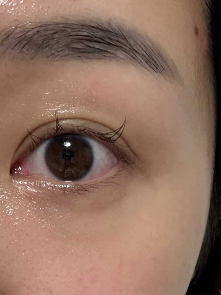 曲美酸+谷胱甘肽眼霜的真实用户使用照片