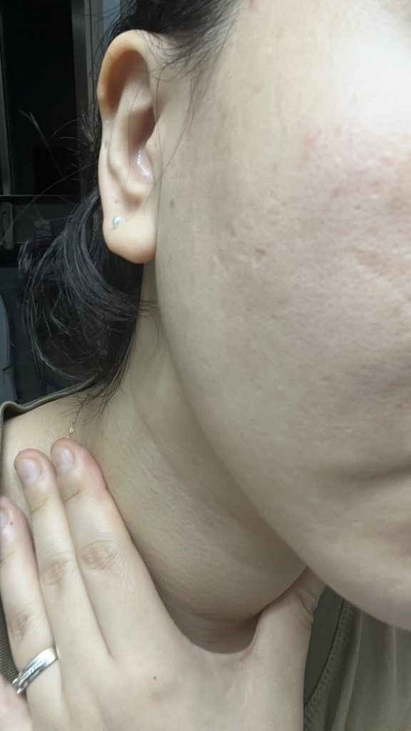 DERMAFACTORY 烟酰胺20%精华液 common.review image