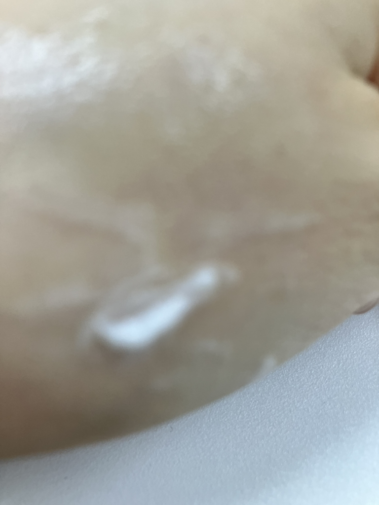 阿托贝瑞365乳液的真实用户使用照片