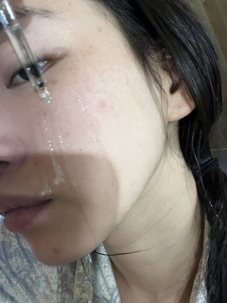 PDRN 玻尿酸胶囊 100 血清的真实用户使用照片