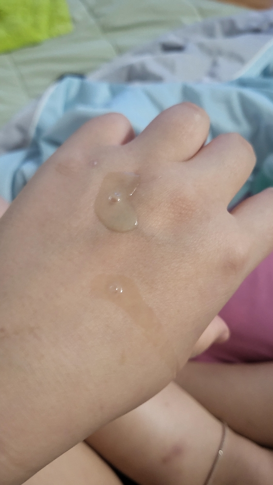 PDRN 玻尿酸胶囊 100 血清的真实用户使用照片